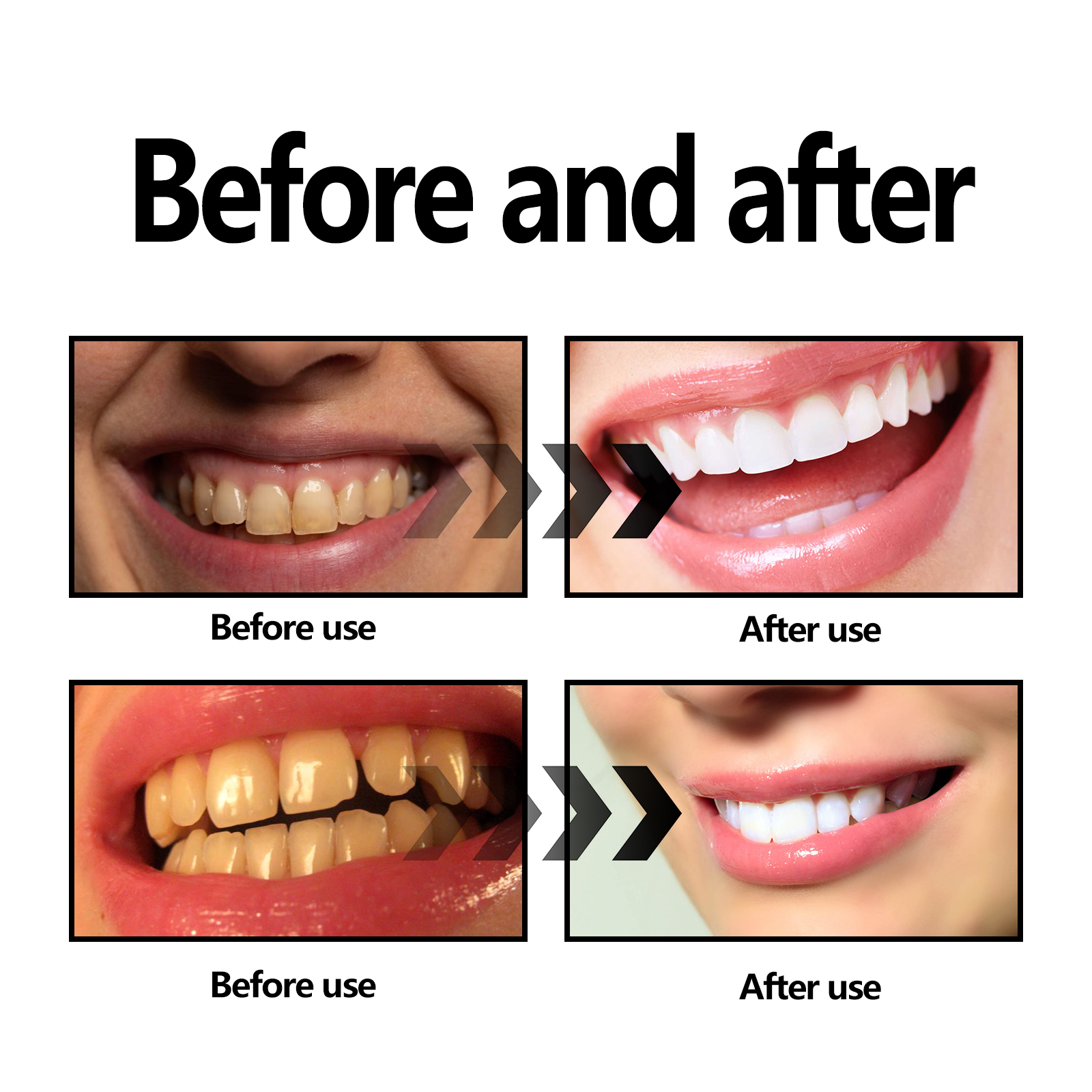 Activated Coconut Charcoal Too - Teeth Whitening Charcoal Powder reseña y precio