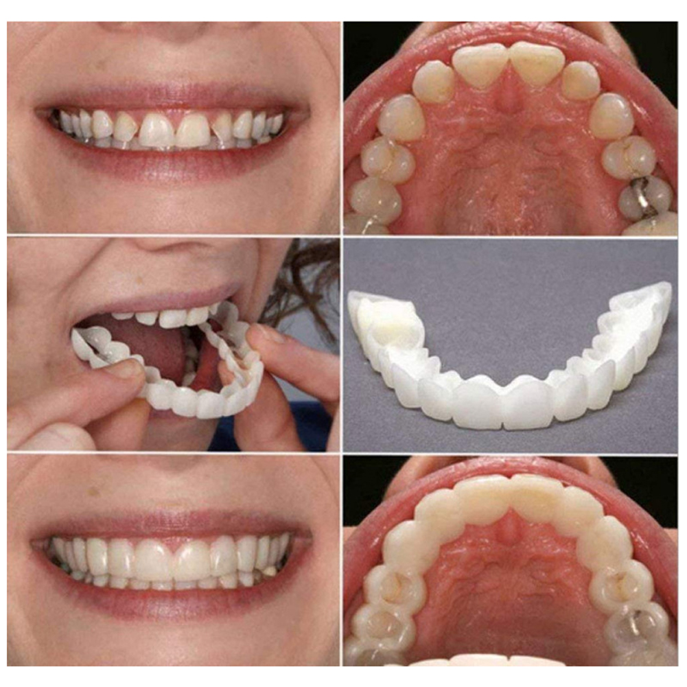 licone Denture Set Fit Tempora - Teeth Whitening Usa reseña y precio