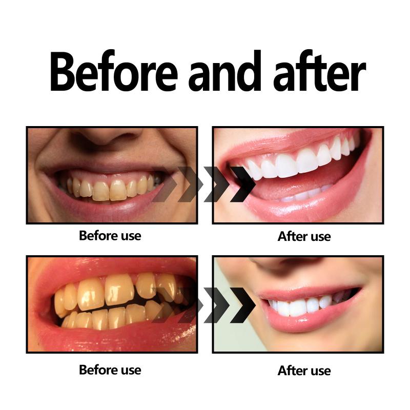Teeth Whitening Powder Charcoa - Teeth Whitening Charcoal Powder reseña y precio