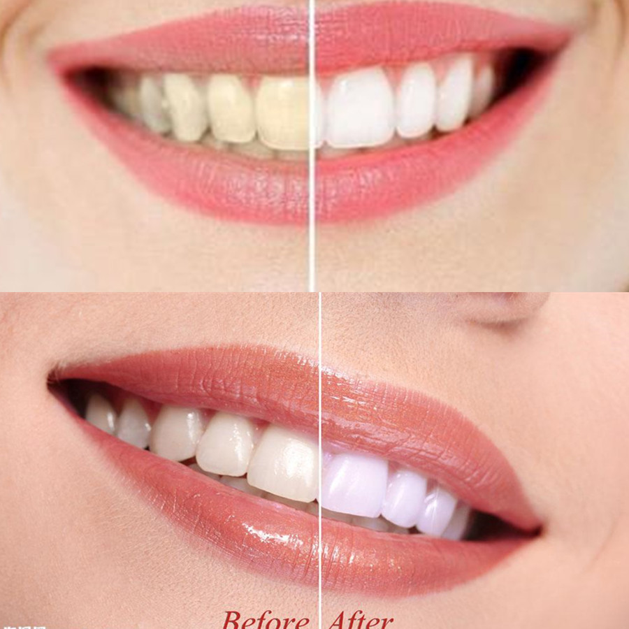 Bamboo Charcoal Teeth Tooth De - Teeth Whitening Remedies reseña y precio