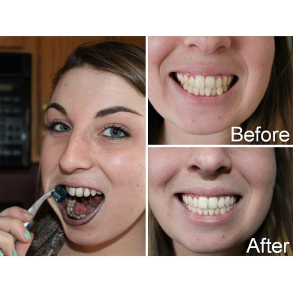 Bamboo Charcoal Teeth Tooth De - Teeth Whitening Remedies reseña y precio