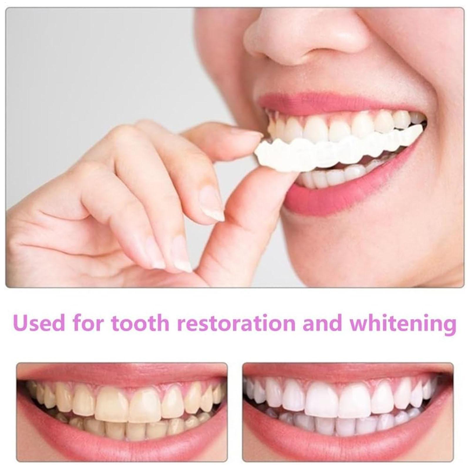 Dental Upper Lower Fake Teeth  - Teeth Whitening In Office reseña y precio