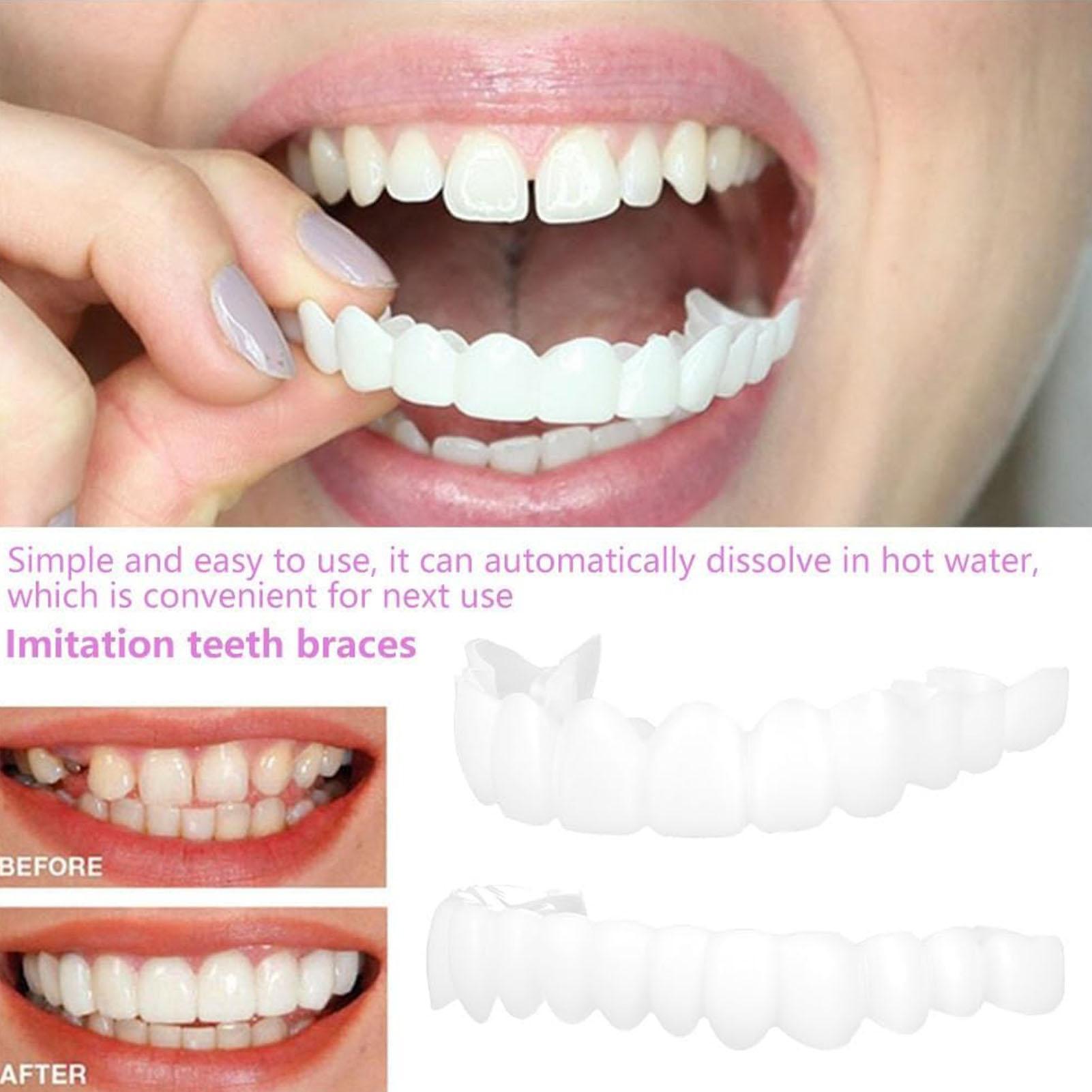 Dental Upper Lower Fake Teeth  - Teeth Whitening In Office reseña y precio