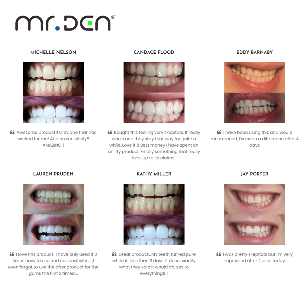 Dr. Whiten 3 Pack Teeth Whiten - Teeth Whitening Usa reseña y precio