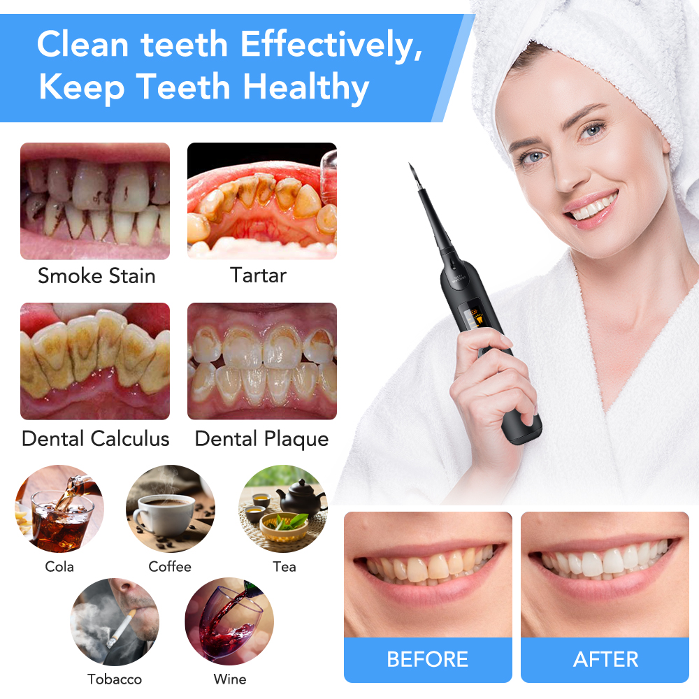 Teeth Tartar Remover Electric  - Teeth Whitening In Office reseña y precio