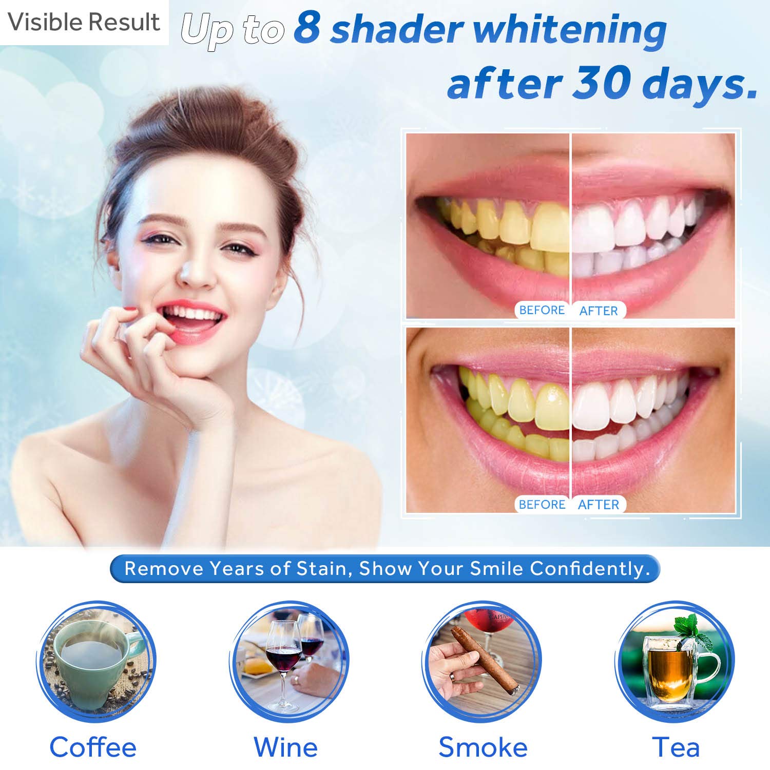 Teeth Whitening Gel Refill Syr - Teeth Whitening Remedies reseña y precio