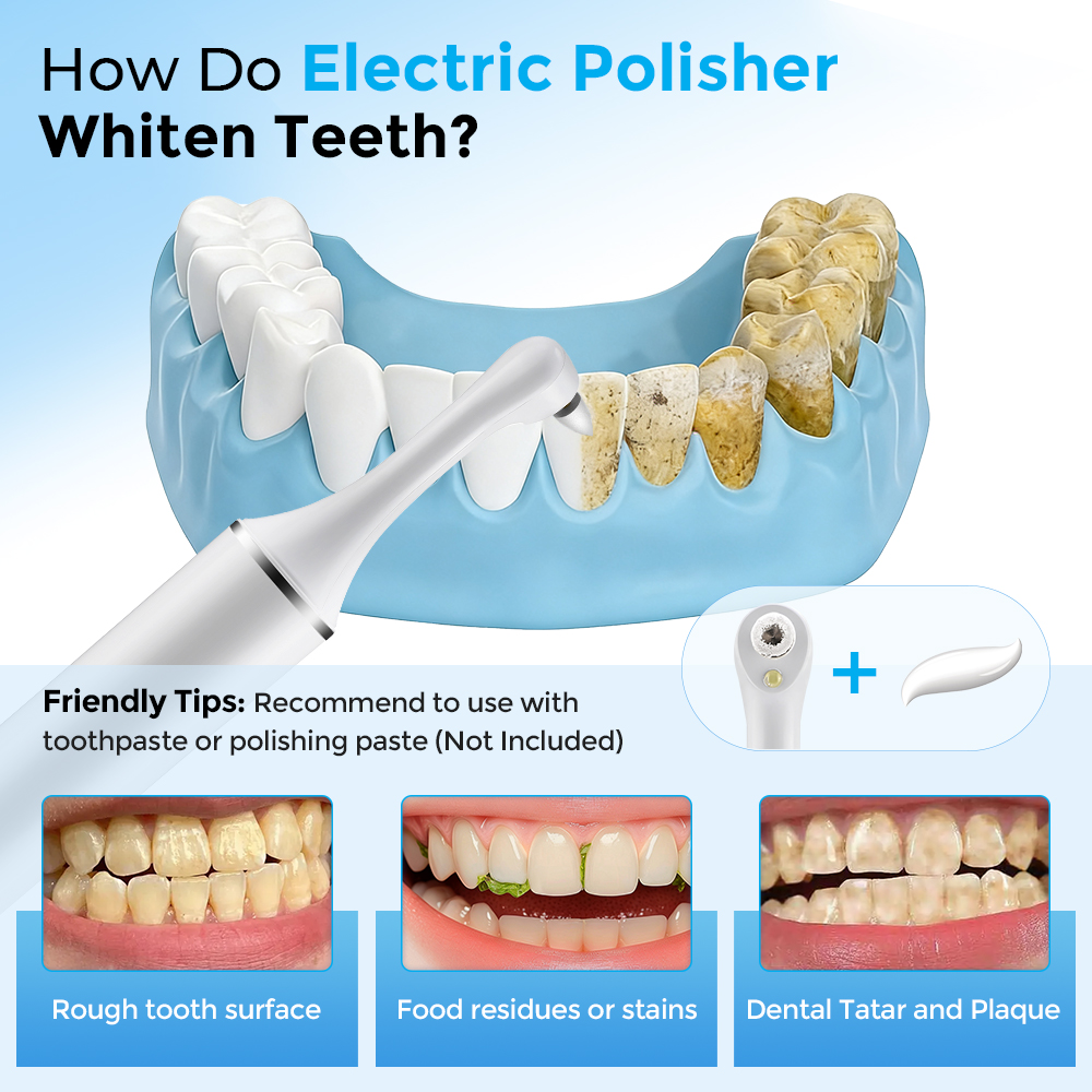 Electric Tooth Polisher Teeth  - Teeth Whitening Led Light reseña y precio