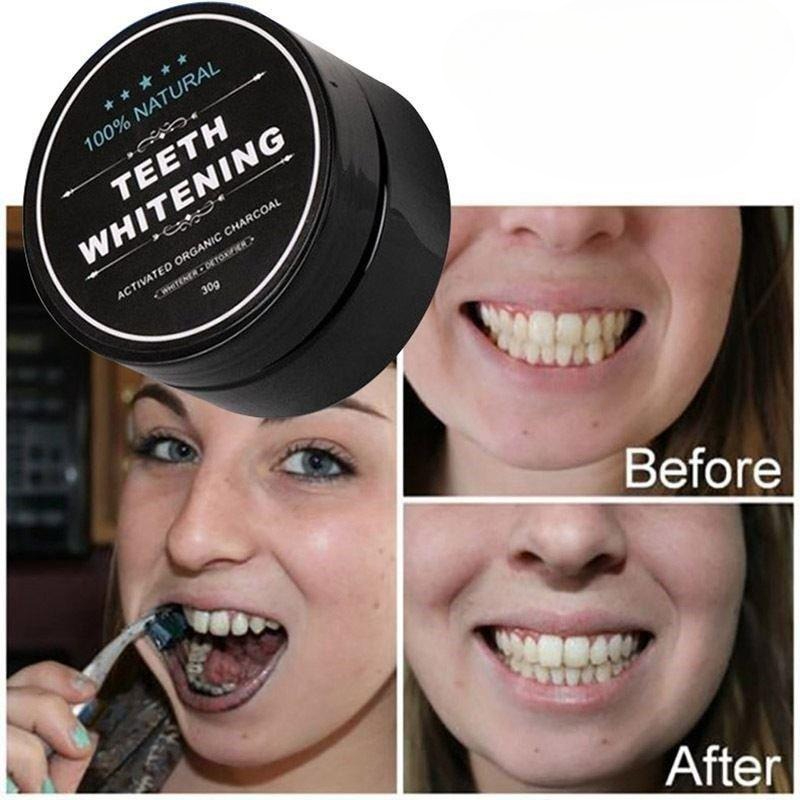 1 Box Activated Charcoal Teeth - Teeth Whitening Charcoal Powder reseña y precio