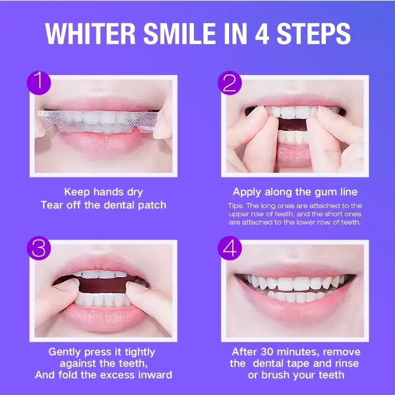 Teeth Whitening Kit - 5X LED L - Teeth Whitening Remedies reseña y precio