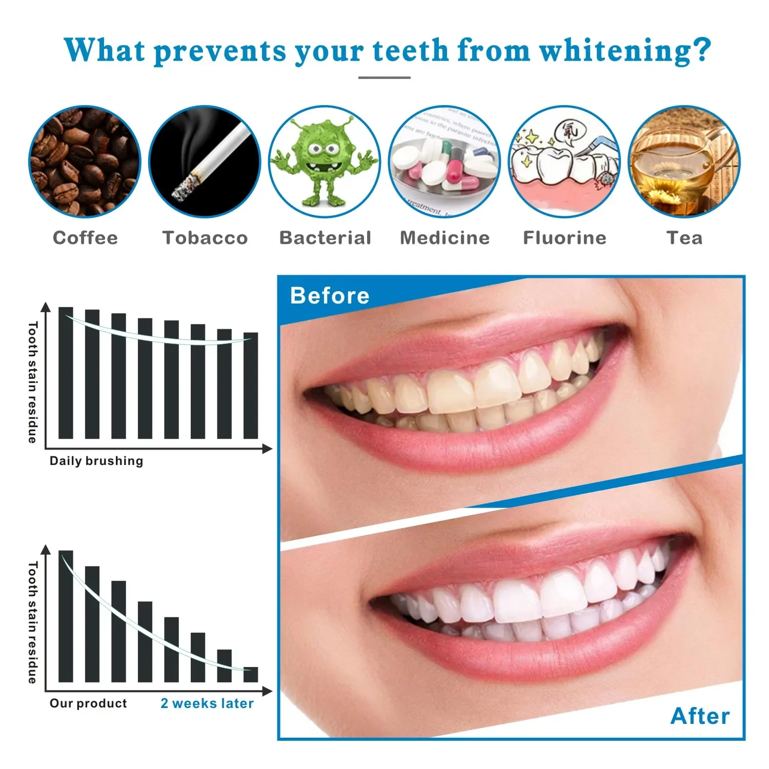 14/28pcs 3D Teeth Whitening St - Whitening Strip 3D reseña y precio