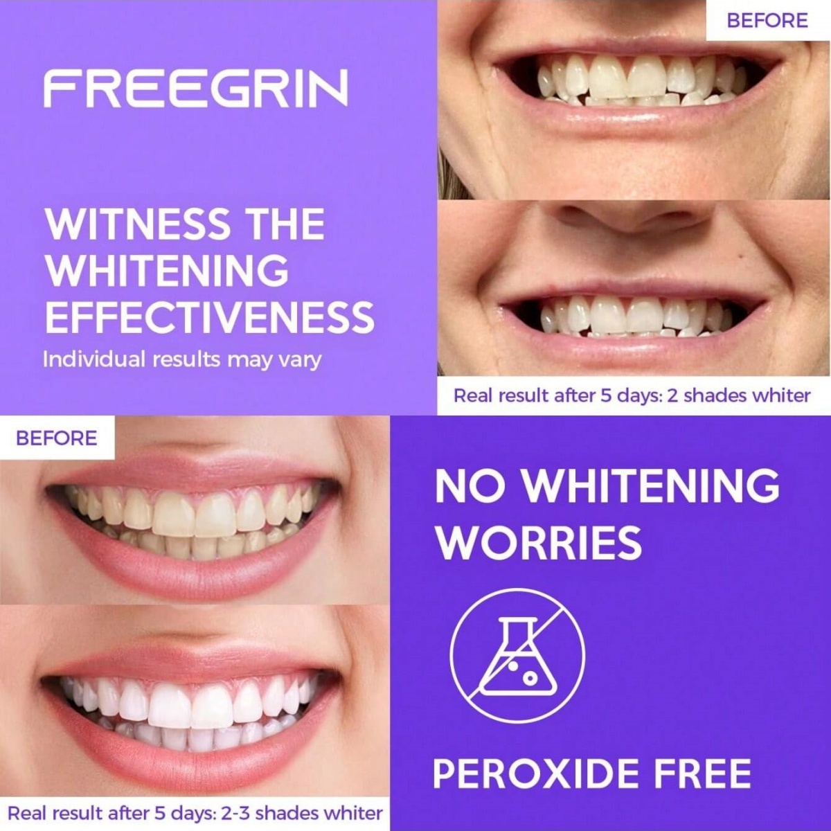 Deluxe Whitening Teeth Sticker - Teeth Whitening In Office reseña y precio