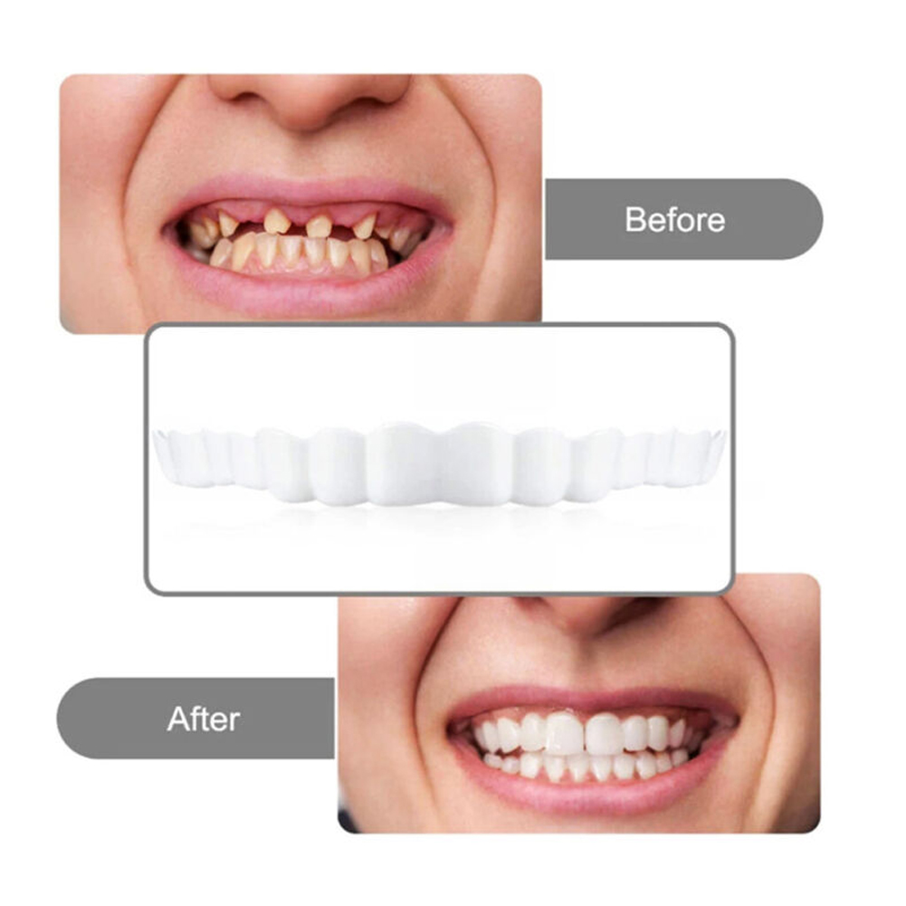 2026icone Denture Set Fit Temp - Teeth Whitening Usa reseña y precio